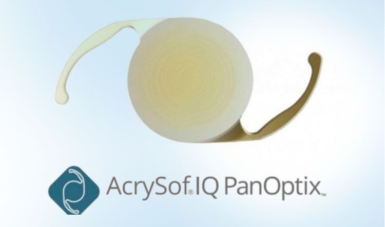 Trifocal lens Alcon Panoptix